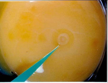  &nbsp; &nbsp; &nbsp; &nbsp; &nbsp; &nbsp; &nbsp; &nbsp; &nbsp; &nbsp; &nbsp; &nbsp; &nbsp; &nbsp; &nbsp; &nbsp; &nbsp; &nbsp; &nbsp; &nbsp; &nbsp; &nbsp; &nbsp; &nbsp; &nbsp; &nbsp; &nbsp; &nbsp; &nbsp; &nbsp; &nbsp; &nbsp; &nbsp; &nbsp; &nbsp; &nbsp; &nbsp; &nbsp; &nbsp; &nbsp; &nbsp; &nbsp; &nbsp; &nbsp; &nbsp; &nbsp; &nbsp; &nbsp; &nbsp; &nbsp; &nbsp; &nbsp; &nbsp; &nbsp;Бластодиск в желтке